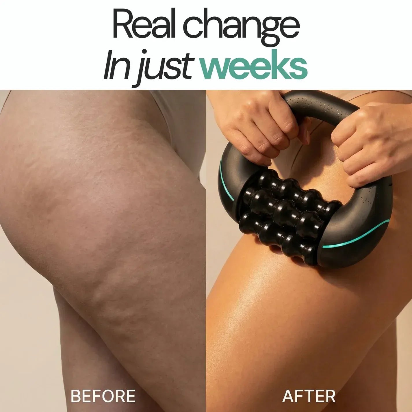LipoRoll™ – The Original Body Shaper