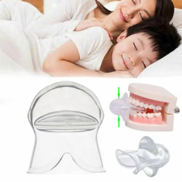 SleepEase Mouthguard