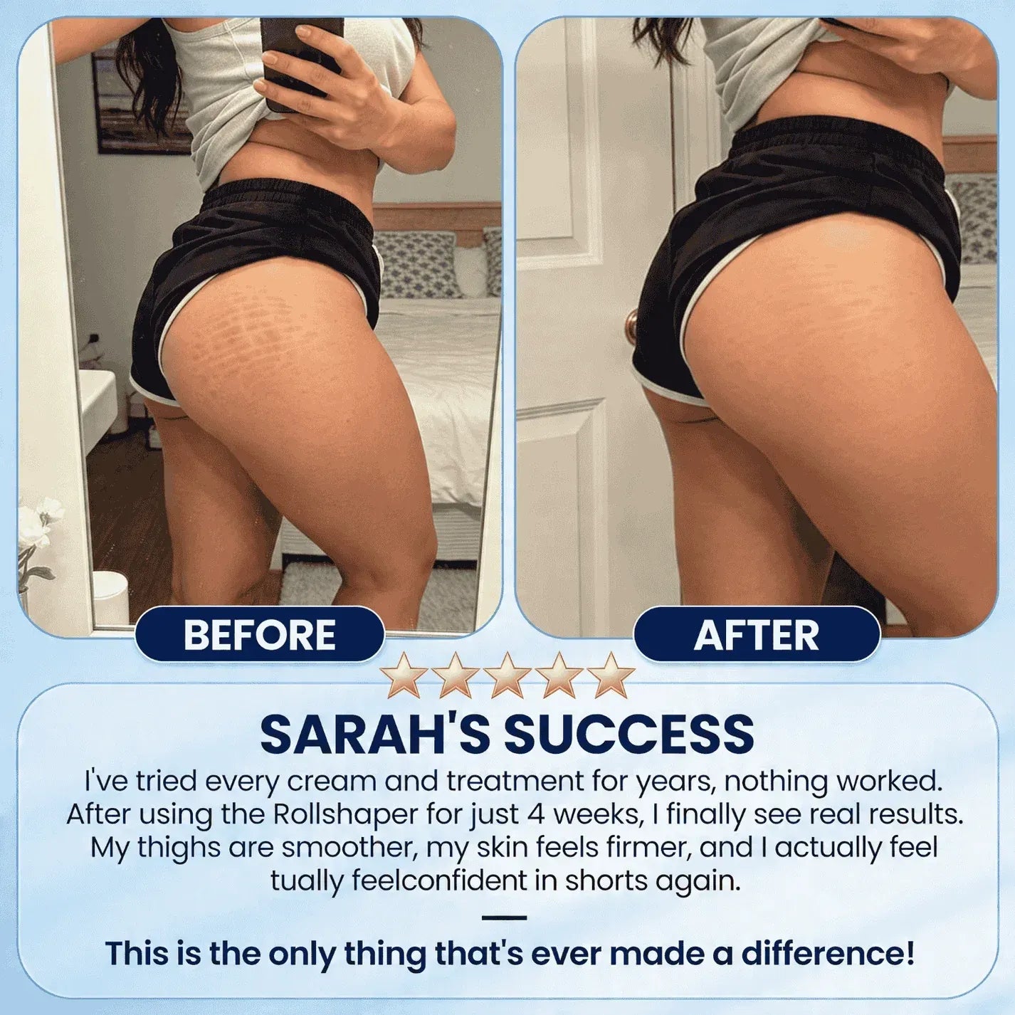 LipoRoll™ – The Original Body Shaper